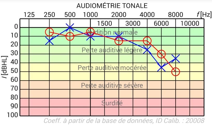 audiogramme