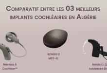 comparatif implant cocleaire