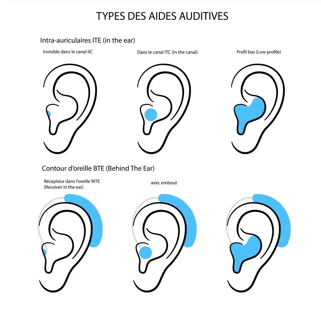 types aides auditives