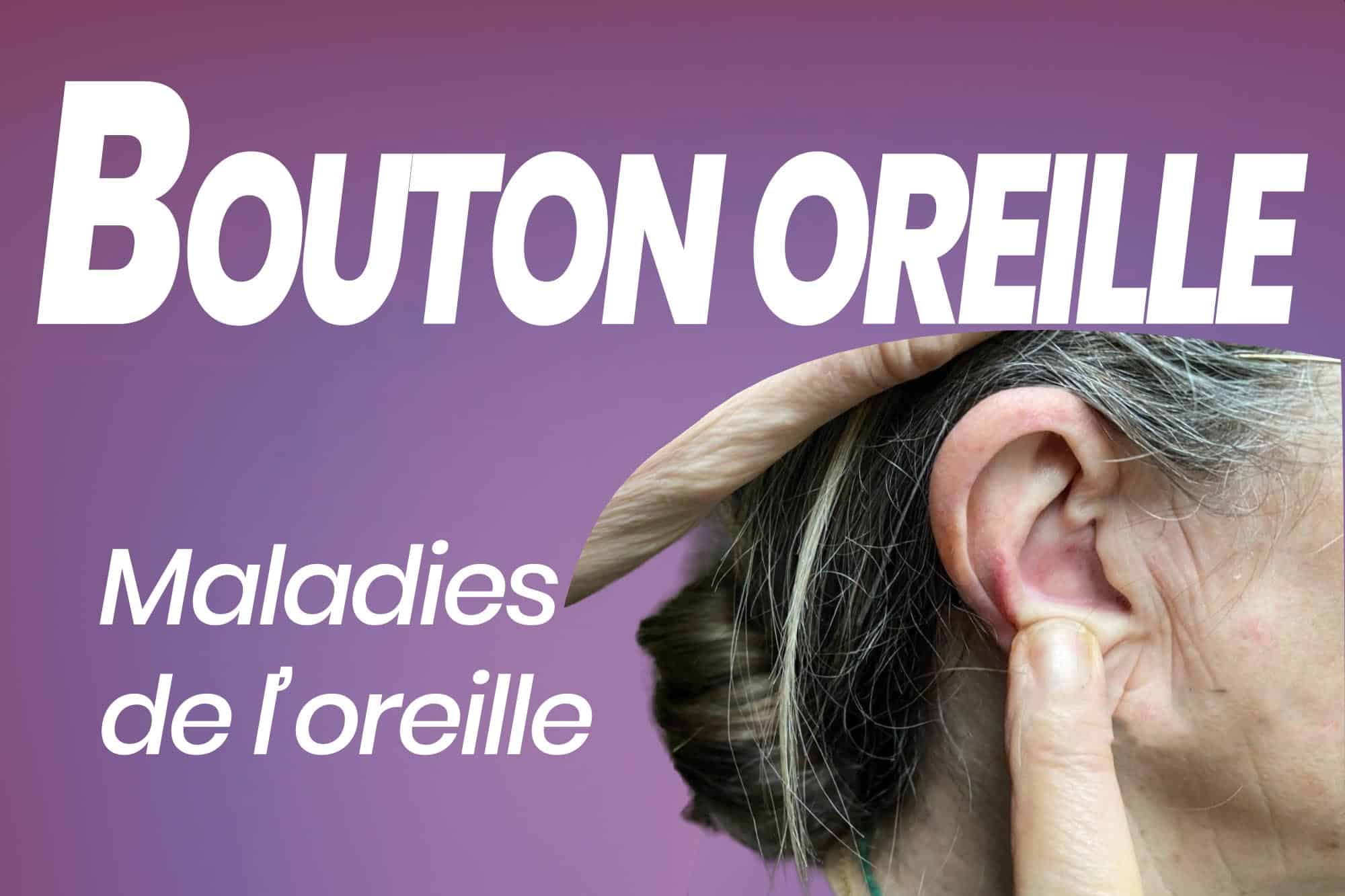Comment traiter les boutons dans l