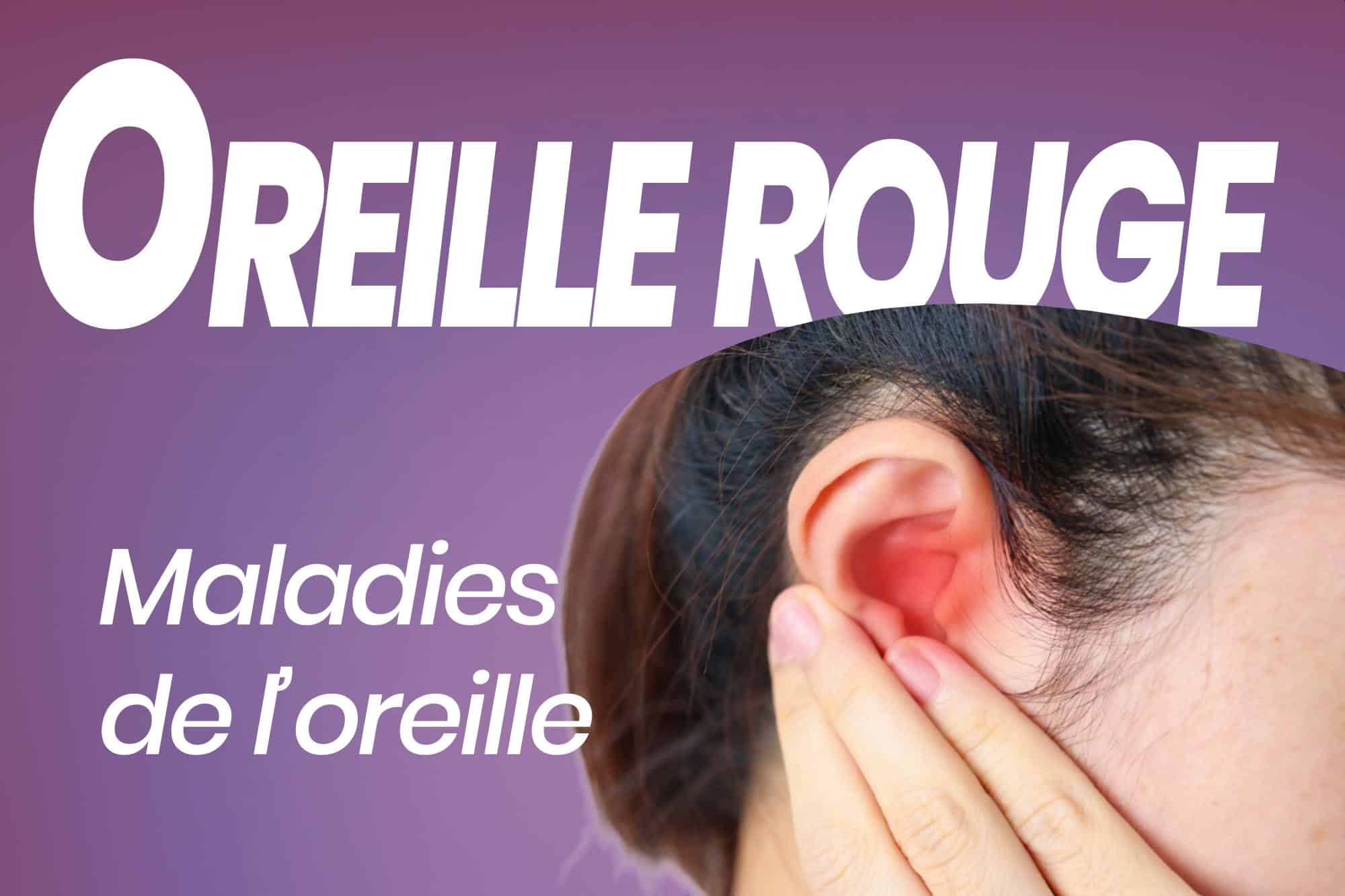 oreille rouge fr