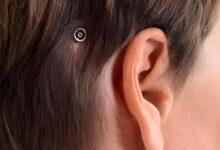 Implant auditif derrière une oreille humaine