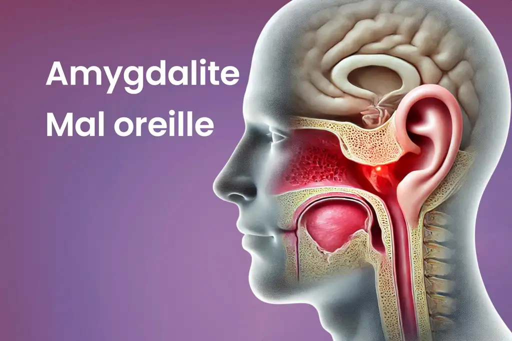 Amygdalite : symptmes, causes et conseils sur l'infection