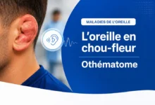 oreille en chou fleur